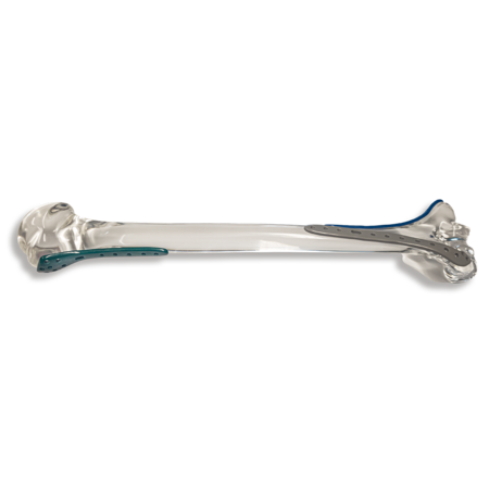 a transparent bone made from PPSU 3D printing material