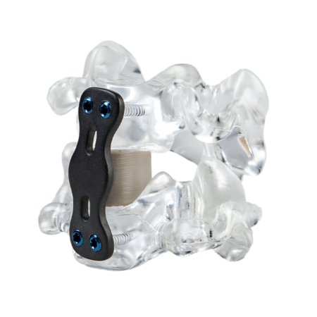 3D printed spinal cage device in PEEK for spinal surgeries 